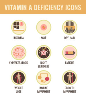 VITAMIN A DEFICIENCY- EVERYTHING YOU MUST KNOW - V Cure