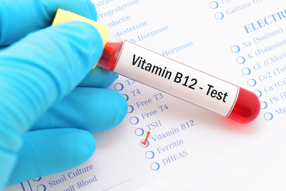 Vitamin B Deficiency- Everything You Should Know - V Cure