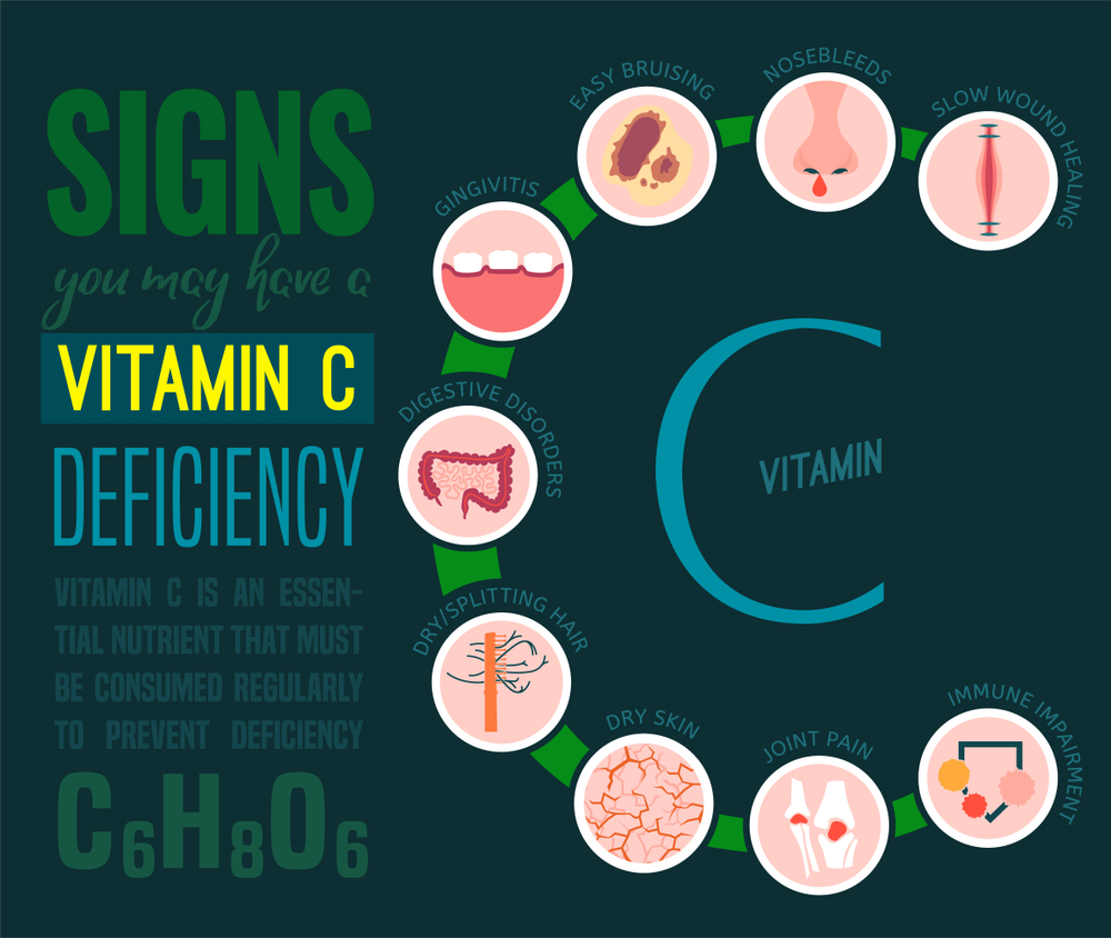 Vitamin C Deficiency Causes Symptoms And Treatment - vrogue.co