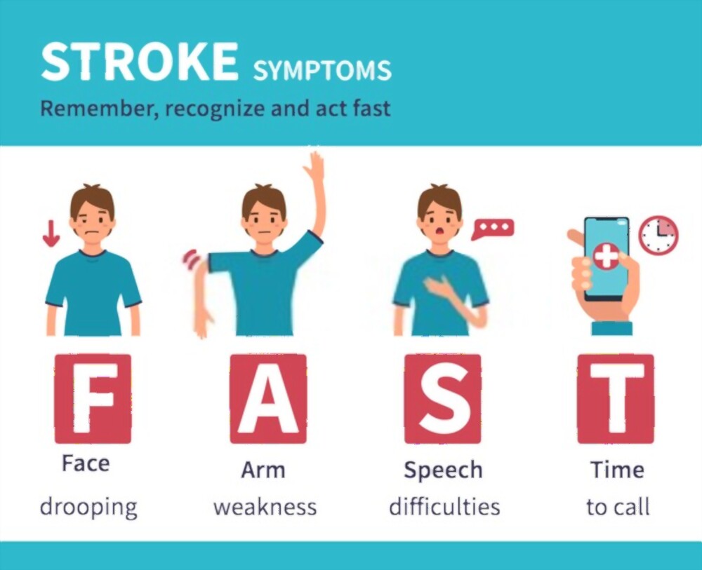 stroke-vcurehealthcare