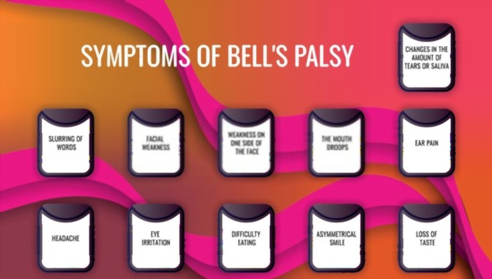 bells palsy- vcurehealthcare