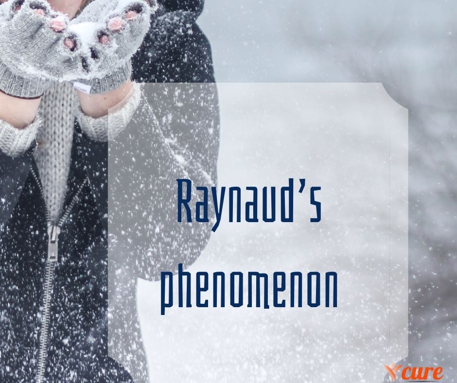 Raynaud’s phenomenon 