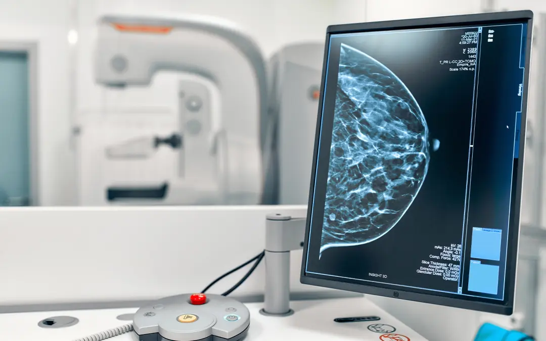 AI improving cancer diagnosis