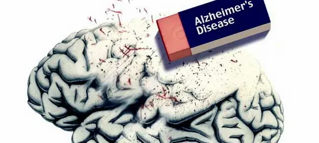 Alzheimer’s disease cause