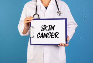 skin cancer early detection