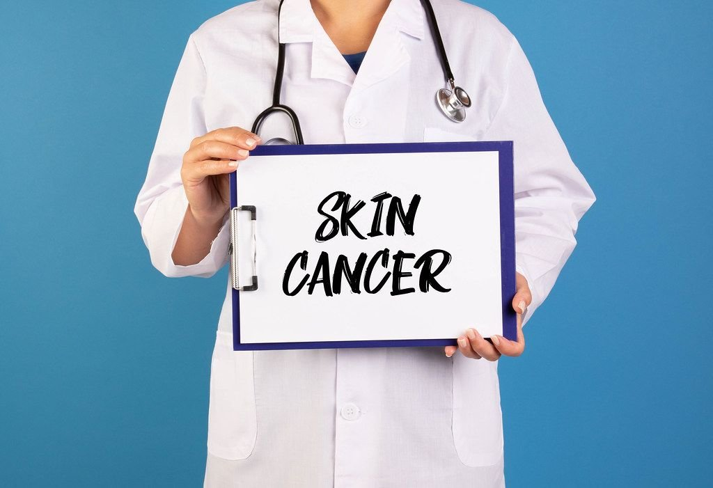 skin cancer early detection