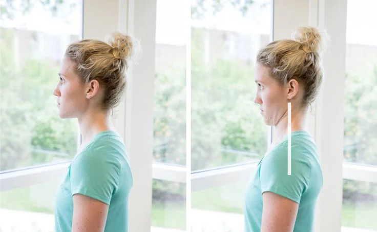 Chin tucks- Posture correction exercises