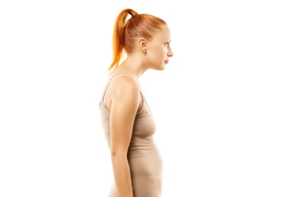 Forward head posture