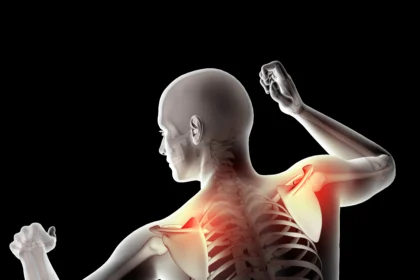 Levator scapulae syndrome