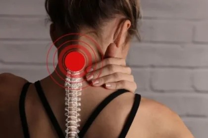 physiotherapy for cervical spondylosis