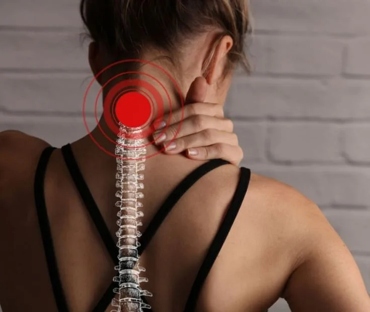 Cervical Spondylosis