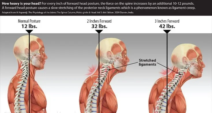 Effects of posture on neck ligaments