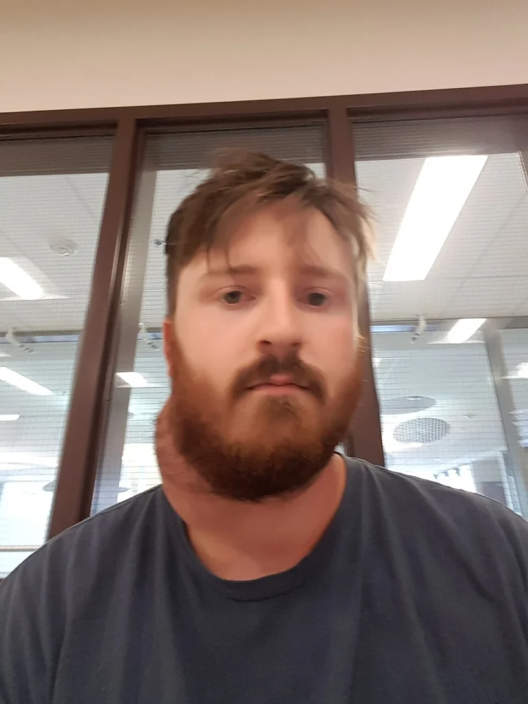 branchial cleft cyst