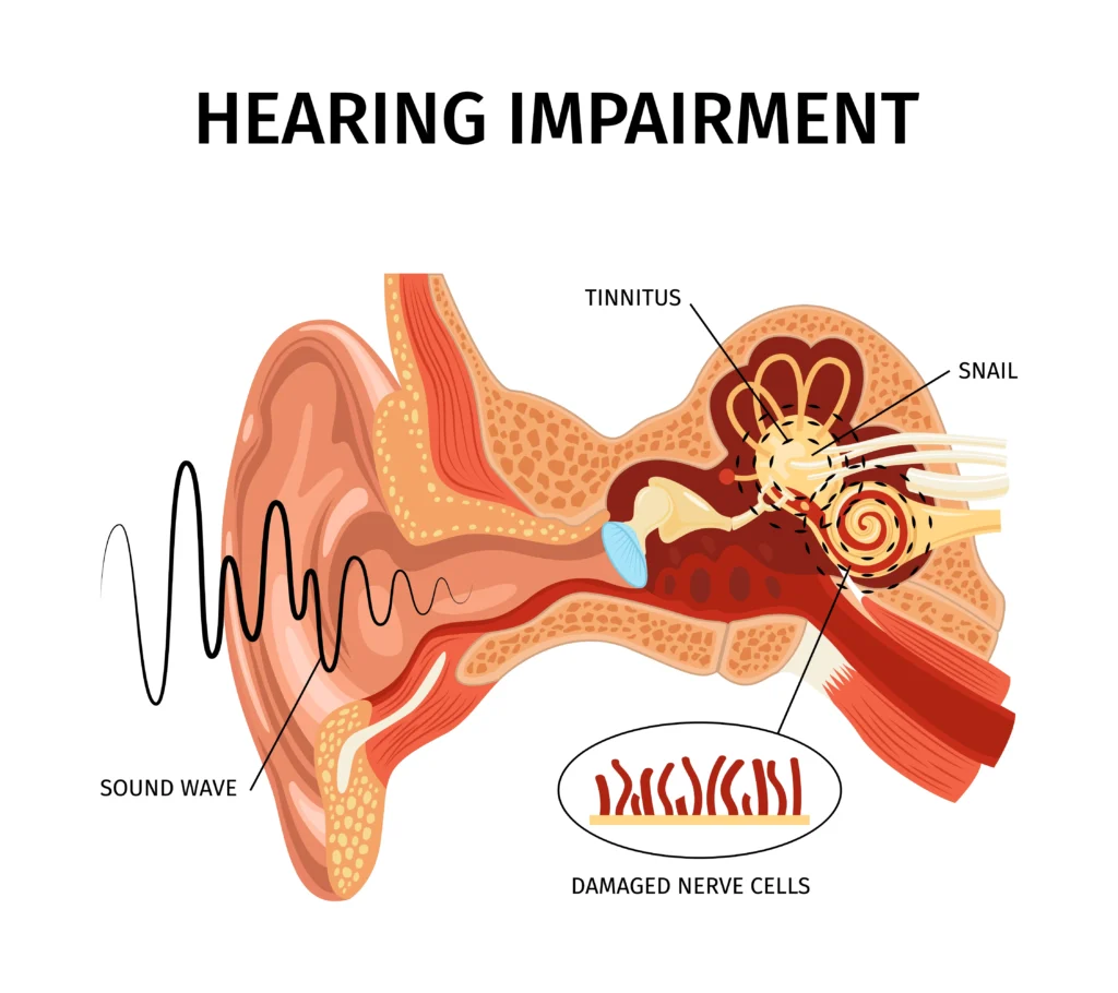 Tinnitus treatment