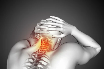 migraine vs cervicogenic headache