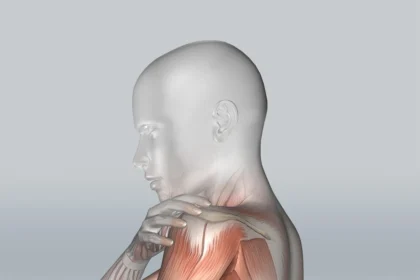 shoulder pain from nerve compression