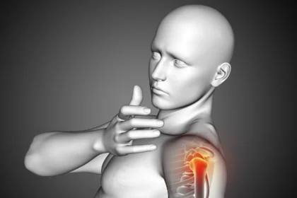 shoulder dislocation treatment at home