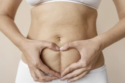 how to reduce C-section scar tightness