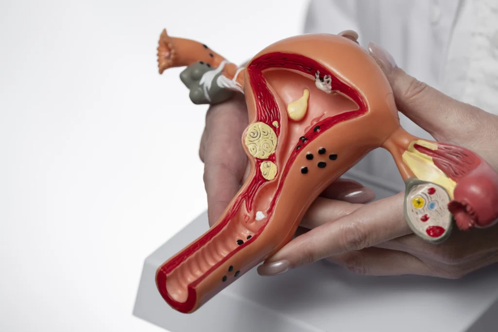 Pelvic Floor Dysfunction in Women