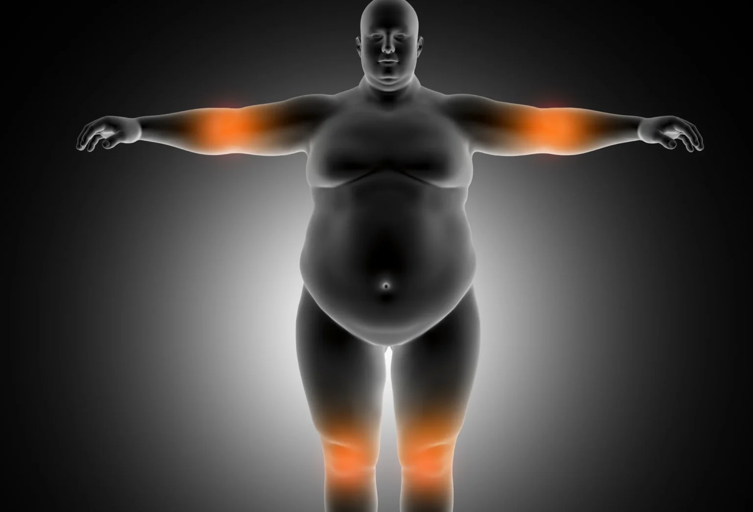 Weight Loss for People With Arthritis: A Safe and Practical Guide - V Cure