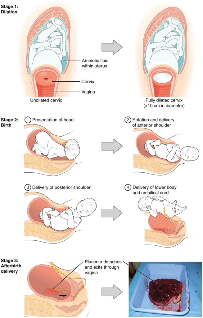 Stages of Labor