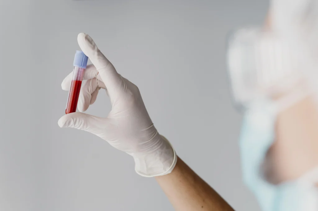 Vitamin D Test During Pregnancy