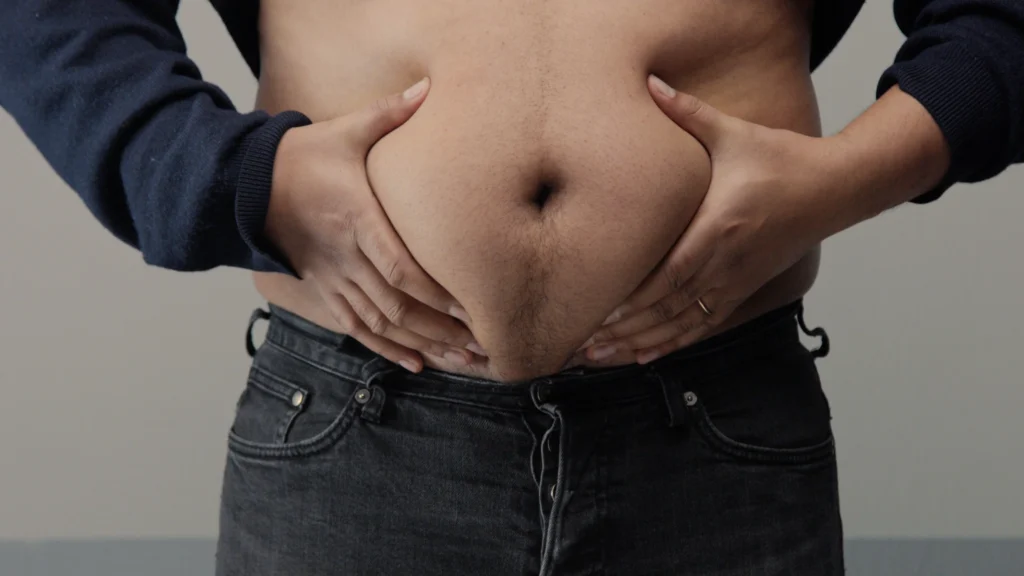 New Mexico Medicaid weight loss drug coverage