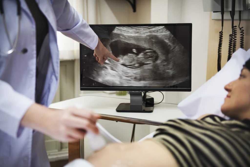 First Trimester Ultrasound Scan