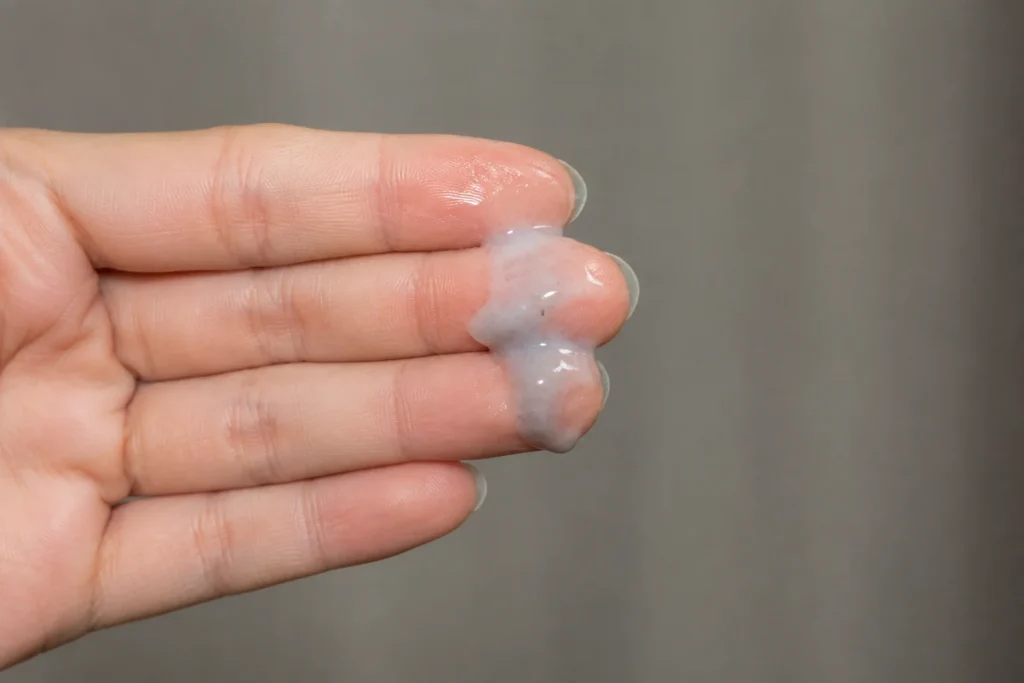Watery Vaginal Discharge