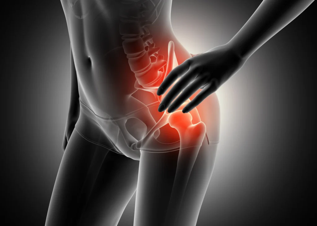 Hip Pain Without Injury