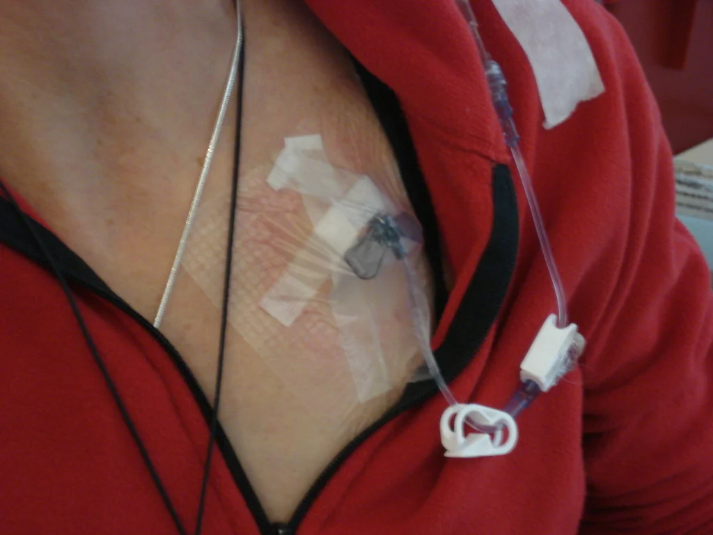 exercises with a breast cancer port