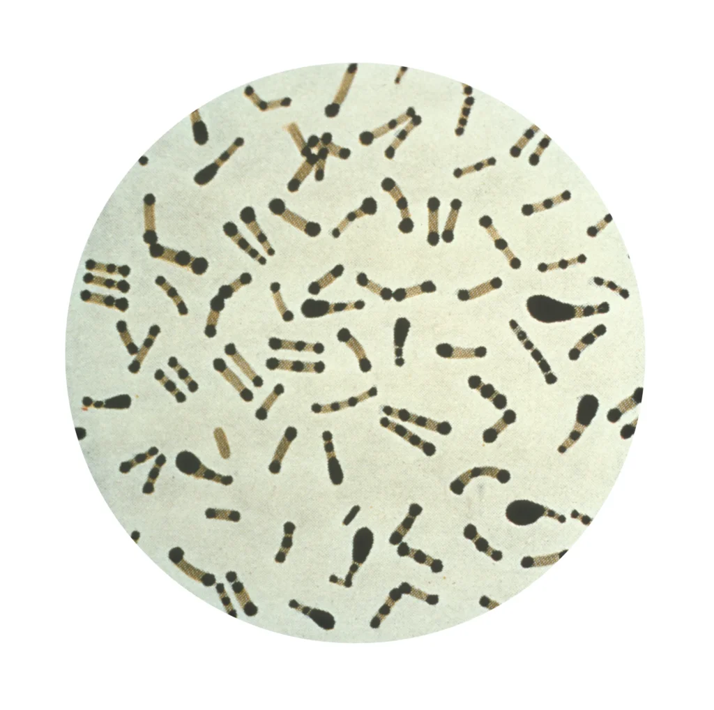 Microscopic image of Corynebacterium diphtheriae bacteria
