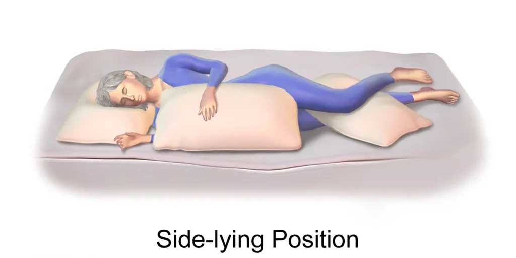 Illustration demonstrating a side-lying position in bed.