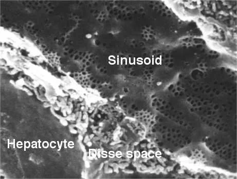 Electron micrograph of a liver sinusoid with fenestrated endothelial cells.