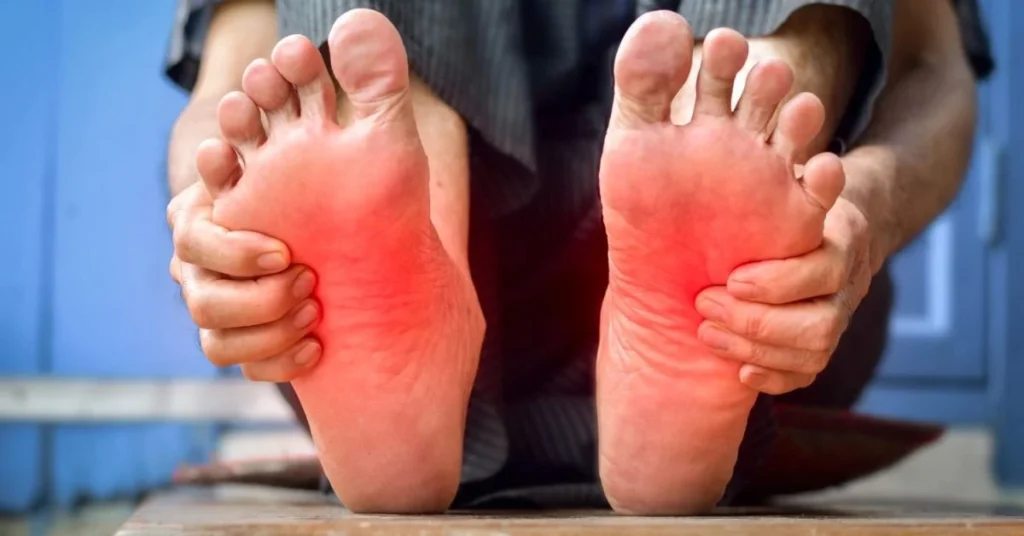 Tibial nerve entrapment at the ankle